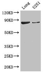 Ythdc1 Polyclonal Antibody - image 2