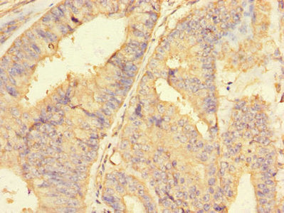 Immunohistochemistry of paraffin-embedded human placental tissue using CAC10976 at dilution of 1:100
