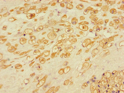 Rbbp8 Polyclonal Antibody - image 3
