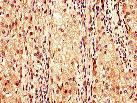 Immunofluorescent analysis of Hela cells using CAC10978 at dilution of 1:100 and Alexa Fluor 488-congugated AffiniPure Goat Anti-Rabbit IgG(H+L)