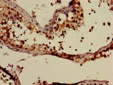 Immunofluorescent analysis of A549 cells using CAC10991 at dilution of 1:100 and Alexa Fluor 488-congugated AffiniPure Goat Anti-Rabbit IgG(H+L)