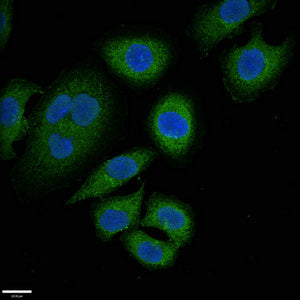 Abcc9 Polyclonal Antibody - image 3