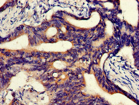 Abca5 Polyclonal Antibody - image 3