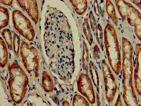 Immunofluorescent analysis of PC-3 cells using CAC11052 at dilution of 1:100 and Alexa Fluor 488-congugated AffiniPure Goat Anti-Rabbit IgG(H+L)