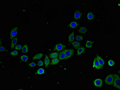 Tmigd2 Polyclonal Antibody - image 3