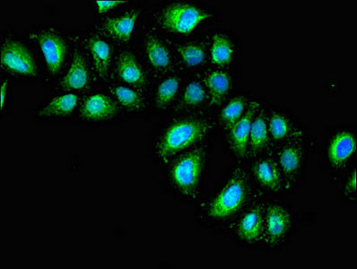 Western Blot; ,Positive WB detected in: A549 whole cell lysate; ,All lanes: IL1R1 antibody at 3µg/ml; ,Secondary; ,Goat polyclonal to rabbit IgG at 1/50000 dilution; ,Predicted band size: 66 kDa; ,Observed band size: 66 kDa;
