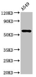 Immunofluorescence staining of HepG2 cells with CAC11065 at 1:100, counter-stained with DAPI. The cells were fixed in 4% formaldehyde, permeabilized using 0.2% Triton X-100 and blocked in 10% normal Goat Serum. The cells were then incubated with the antibody overnight at 4°C. The secondary antibody was Alexa Fluor 488-congugated AffiniPure Goat Anti-Rabbit IgG(H+L).