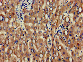 Immunofluorescent analysis of HepG2 cells using CAC11068 at dilution of 1:100 and Alexa Fluor 488-congugated AffiniPure Goat Anti-Rabbit IgG(H+L)