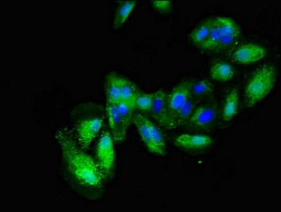 Alcam Polyclonal Antibody - image 3