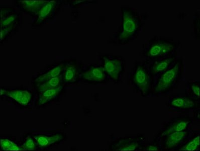 Western Blot; ,Positive WB detected in: Rat lung tissue, Rat heart tissue; ,All lanes: POLL antibody at 2.4µg/ml; ,Secondary; ,Goat polyclonal to rabbit IgG at 1/50000 dilution; ,Predicted band size: 64, 34 kDa; ,Observed band size: 64 kDa;