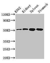 Immunofluorescent analysis of A549 cells using CAC11111 at dilution of 1:100 and Alexa Fluor 488-congugated AffiniPure Goat Anti-Rabbit IgG(H+L)