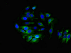 Aldh3B1 Polyclonal Antibody - image 3