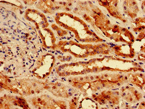Immunofluorescent analysis of HepG2 cells using CAC11112 at dilution of 1:100 and Alexa Fluor 488-congugated AffiniPure Goat Anti-Rabbit IgG(H+L)