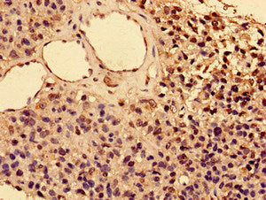 Immunofluorescent analysis of HepG2 cells using CAC11137 at dilution of 1:100 and Alexa Fluor 488-congugated AffiniPure Goat Anti-Rabbit IgG(H+L)