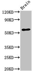 Immunohistochemistry of paraffin-embedded human eye tissue using CAC11154 at dilution of 1:100