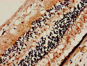 Immunofluorescent analysis of HepG2 cells using CAC11154 at dilution of 1:100 and Alexa Fluor 488-congugated AffiniPure Goat Anti-Rabbit IgG(H+L)