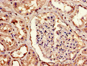 Immunofluorescent analysis of HepG2 cells using CAC11156 at dilution of 1:100 and Alexa Fluor 488-congugated AffiniPure Goat Anti-Rabbit IgG(H+L)