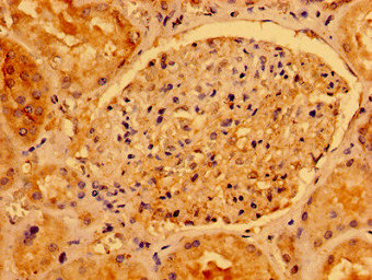 Immunoprecipitating AACS in HEK293 whole cell lysate; , Lane 1: Rabbit control IgG instead in HEK293 whole cell lysate. For western blotting, a HRP-conjugated Protein G antibody was used as the secondary antibody (1/2000); , Lane 2: CAC11159 (8µg) + HEK293 whole cell lysate (500µg); , Lane 3: HEK293 whole cell lysate (10µg)