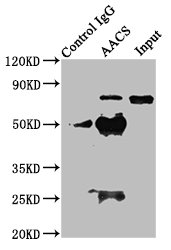 Aacs Polyclonal Antibody - image 4