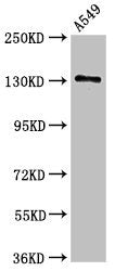 Immunofluorescence staining of HepG2 cells with CAC11160 at 1:166, counter-stained with DAPI. The cells were fixed in 4% formaldehyde, permeabilized using 0.2% Triton X-100 and blocked in 10% normal Goat Serum. The cells were then incubated with the antibody overnight at 4°C. The secondary antibody was Alexa Fluor 488-congugated AffiniPure Goat Anti-Rabbit IgG(H+L).