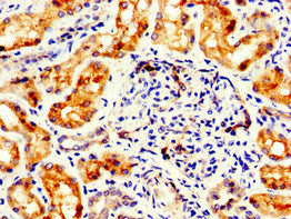 Immunofluorescent analysis of A549 cells using CAC11174 at dilution of 1:100 and Alexa Fluor 488-congugated AffiniPure Goat Anti-Rabbit IgG(H+L)
