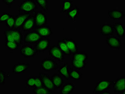 Fli1 Polyclonal Antibody - image 5
