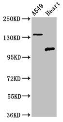 Immunohistochemistry of paraffin-embedded human liver cancer using CAC11186 at dilution of 1:100