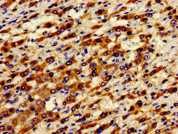 Immunofluorescent analysis of HepG2 cells using CAC11186 at dilution of 1:100 and Alexa Fluor 488-congugated AffiniPure Goat Anti-Rabbit IgG(H+L)