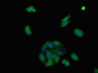 Adgra2 Polyclonal Antibody - image 4