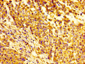 Immunohistochemistry of paraffin-embedded human thyroid tissue using CAC11193 at dilution of 1:100