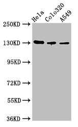 Immunohistochemistry of paraffin-embedded human glioma using CAC11195 at dilution of 1:100