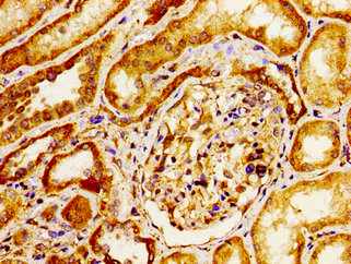 Immunofluorescent analysis of Hela cells using CAC11195 at dilution of 1:100 and Alexa Fluor 488-congugated AffiniPure Goat Anti-Rabbit IgG(H+L)