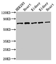 Immunohistochemistry of paraffin-embedded human brain tissue using CAC11204 at dilution of 1:100