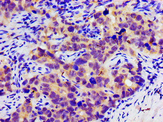 Slc25A12 Polyclonal Antibody - image 4