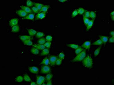Rps6Ka2 Polyclonal Antibody - image 3
