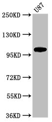 Immunohistochemistry of paraffin-embedded human pancreatic cancer using CAC11221 at dilution of 1:100