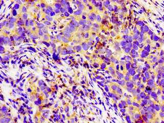 Immunohistochemistry of paraffin-embedded human appendix tissue using CAC11221 at dilution of 1:100