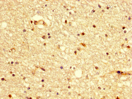 Bdkrb2 Polyclonal Antibody - image 3