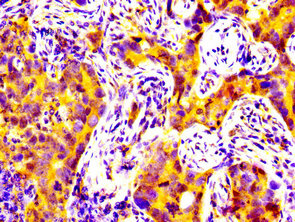 Matn2 Polyclonal Antibody - image 2