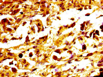IHC image diluted at 1:400 and staining in paraffin-embedded human brain tissue performed on a Leica BondTM system. After dewaxing and hydration, antigen retrieval was mediated by high pressure in a citrate buffer (pH 6.0). Section was blocked with 10% normal goat serum 30min at RT. Then primary antibody (1% BSA) was incubated at 4°C overnight. The primary is detected by a biotinylated secondary antibody and visualized using an HRP conjugated SP system.