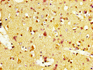 Immunofluorescence staining of Hela cells with CAC11237 at 1:133, counter-stained with DAPI. The cells were fixed in 4% formaldehyde, permeabilized using 0.2% Triton X-100 and blocked in 10% normal Goat Serum. The cells were then incubated with the antibody overnight at 4°C. The secondary antibody was Alexa Fluor 488-congugated AffiniPure Goat Anti-Rabbit IgG(H+L).