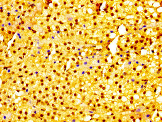 Immunofluorescence staining of HepG2 cells with CAC11247 at 1:100, counter-stained with DAPI. The cells were fixed in 4% formaldehyde, permeabilized using 0.2% Triton X-100 and blocked in 10% normal Goat Serum. The cells were then incubated with the antibody overnight at 4°C. The secondary antibody was Alexa Fluor 488-congugated AffiniPure Goat Anti-Rabbit IgG(H+L).