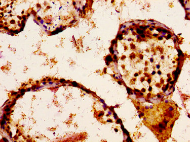 Immunofluorescence staining of Hela cells with CAC11249 at 1:100, counter-stained with DAPI. The cells were fixed in 4% formaldehyde, permeabilized using 0.2% Triton X-100 and blocked in 10% normal Goat Serum. The cells were then incubated with the antibody overnight at 4°C. The secondary antibody was Alexa Fluor 488-congugated AffiniPure Goat Anti-Rabbit IgG(H+L).