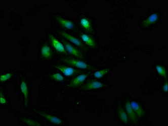 Scn9A Polyclonal Antibody - image 4