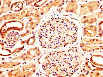 Immunofluorescence staining of Hela cells with CAC11250 at 1:155, counter-stained with DAPI. The cells were fixed in 4% formaldehyde, permeabilized using 0.2% Triton X-100 and blocked in 10% normal Goat Serum. The cells were then incubated with the antibody overnight at 4°C. The secondary antibody was Alexa Fluor 488-congugated AffiniPure Goat Anti-Rabbit IgG(H+L).