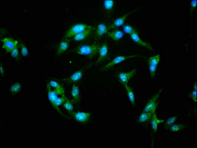 Nfatc3 Polyclonal Antibody - image 4