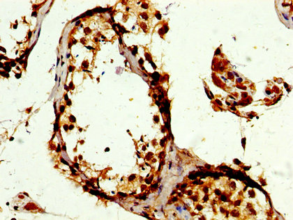 Immunofluorescence staining of MCF-7 cells with CAC11251 at 1:100, counter-stained with DAPI. The cells were fixed in 4% formaldehyde, permeabilized using 0.2% Triton X-100 and blocked in 10% normal Goat Serum. The cells were then incubated with the antibody overnight at 4°C. The secondary antibody was Alexa Fluor 488-congugated AffiniPure Goat Anti-Rabbit IgG(H+L).
