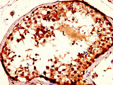 Nup93 Polyclonal Antibody - image 2
