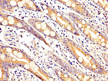 Immunofluorescence staining of HepG2 cells with CAC11263 at 1:66, counter-stained with DAPI. The cells were fixed in 4% formaldehyde, permeabilized using 0.2% Triton X-100 and blocked in 10% normal Goat Serum. The cells were then incubated with the antibody overnight at 4°C. The secondary antibody was Alexa Fluor 488-congugated AffiniPure Goat Anti-Rabbit IgG(H+L).