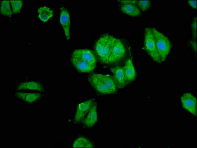 Arhgap18 Polyclonal Antibody - image 4